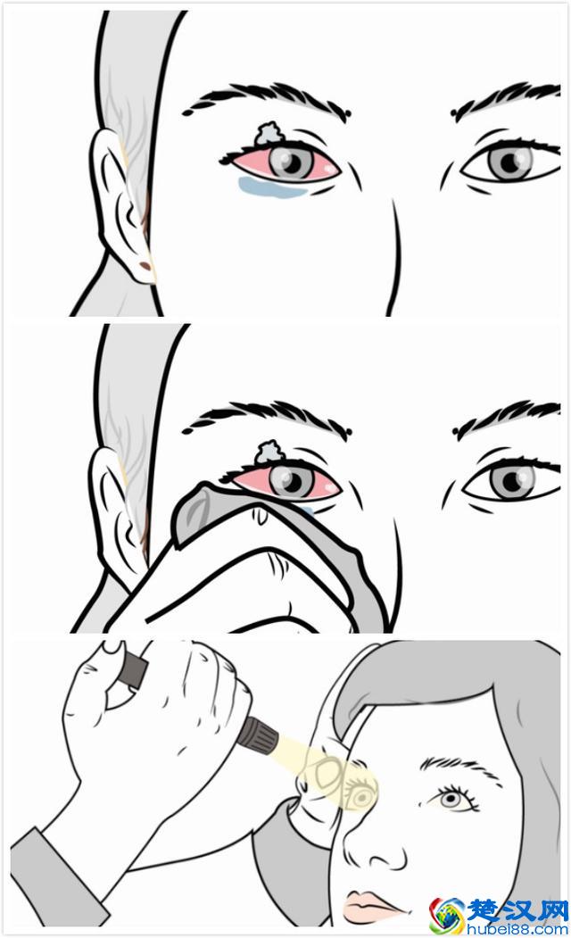 史上最全去除强力胶的妙招,久病成医的工人亲自口述!还不用花钱