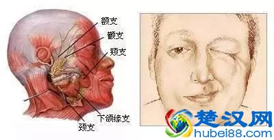 左眼跳是什么预兆，左眼跳小心是这4种疾病