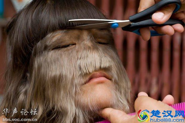 11岁女孩，脸上长满长毛，被称做“狼女”