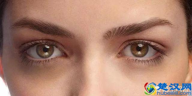 什么原因导致的黑眼圈？