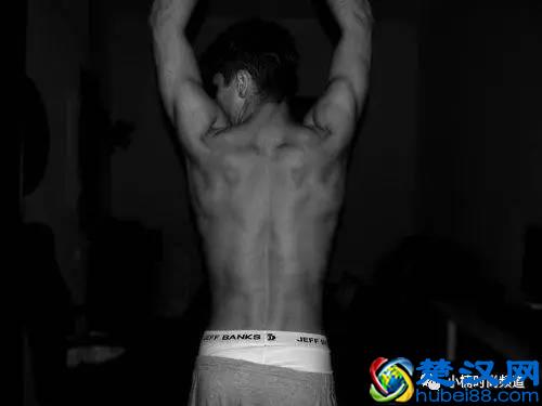 男士：背部长痘痘该怎么办？皮肤科医生整理出5大解决方法！