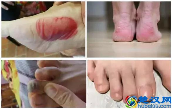 你穿什么袜子跑步？穿对了袜子，PB来得更快