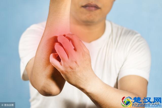 患上湿疹怎么办？这6个治疗方法你都试了吗？