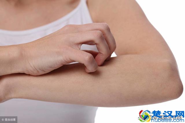 患上湿疹怎么办？这6个治疗方法你都试了吗？