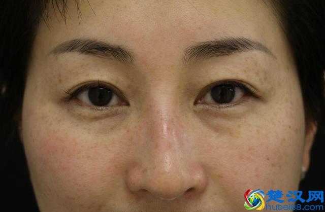 脸上色斑很难看？不用愁，教你一招，让你的脸色比化了妆还好看