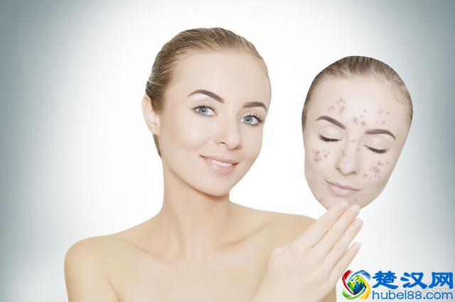 脸上有了斑，该怎么消除？不同的斑点有不同办法