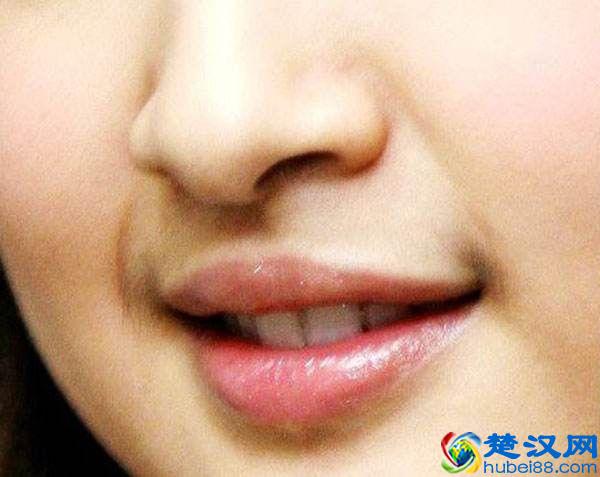 女生嘴唇上汗毛重是怎么回事？吃哪些东西可以缓解？