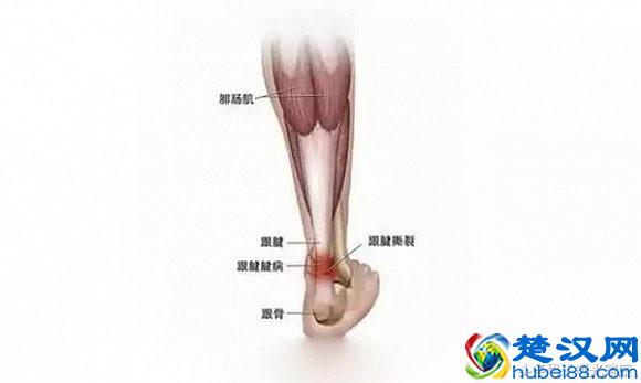脚后跟麻痛是怎么回事？生活中几个小动作可缓解