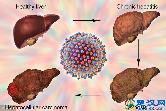 身上出现这种“小红点”，千万别忽视，可能是肝在向你求救！