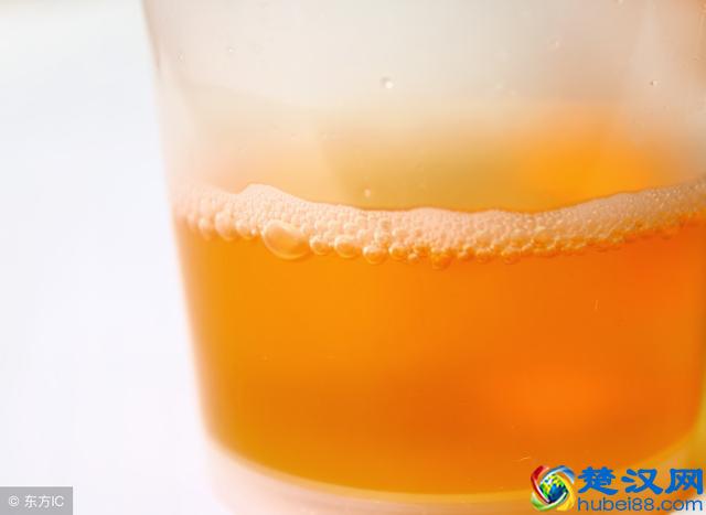 身上出现这种“小红点”，千万别忽视，可能是肝在向你求救！