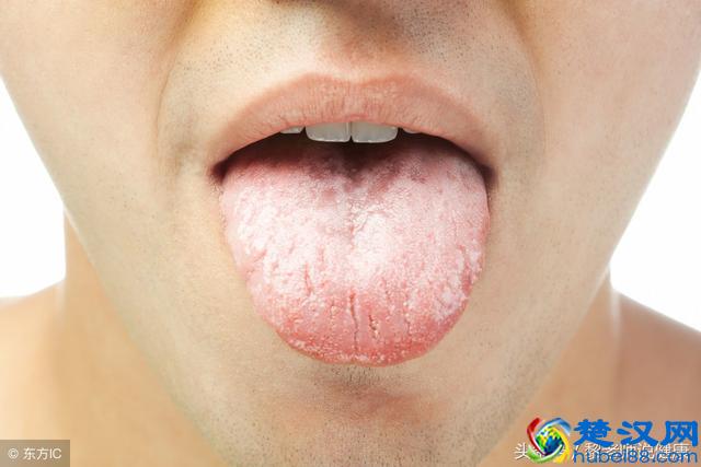 “祛痘神器”硫磺皂，你还在用吗？这3个坏处，你应该要知道！