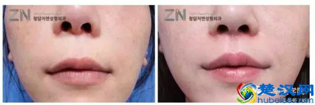 大小S明明五官长一样，为什么大部分人觉得大S比小S美？