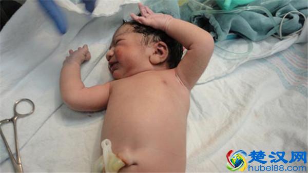 避孕环有四种，各有什么优缺点？