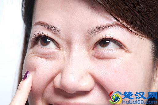 如何去眼袋和皱纹？