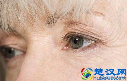 脸上有细纹怎么办？