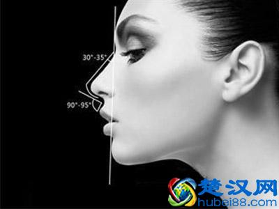 鼻翼缩小，让你的五官立起来