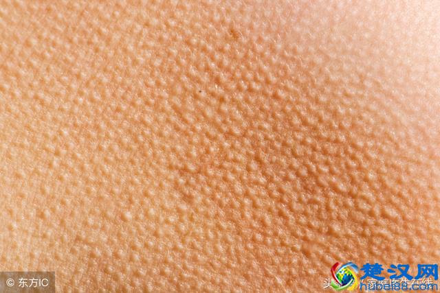 满身“鸡皮肤”，夏天不敢露？这四个方法可以治