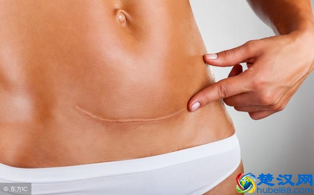 伤口想除疤，日常有5个注意！你能全部做到吗？