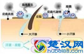 冬天宜治香港脚？没错！这样做断根不复发！