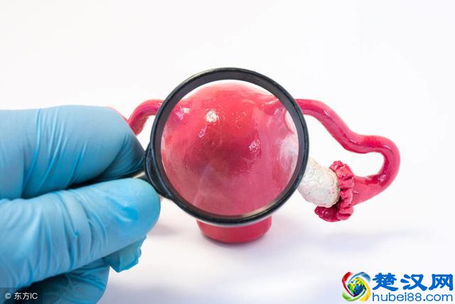 宫颈纳氏囊肿是什么疾病？得了宫颈纳氏囊肿要怎么调理