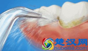 史上最全牙齿美白方法，没有之一！