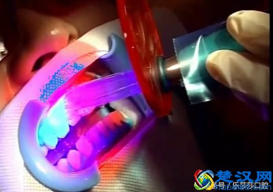 史上最全牙齿美白方法，没有之一！