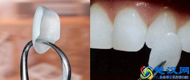 史上最全牙齿美白方法，没有之一！