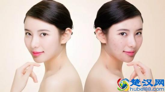 脸部毛孔粗大是什么原因？