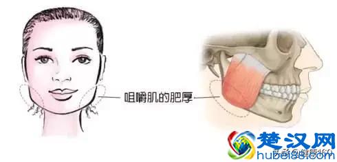 为什么会磨牙？罪魁祸首可能是这6个，4种方法可治