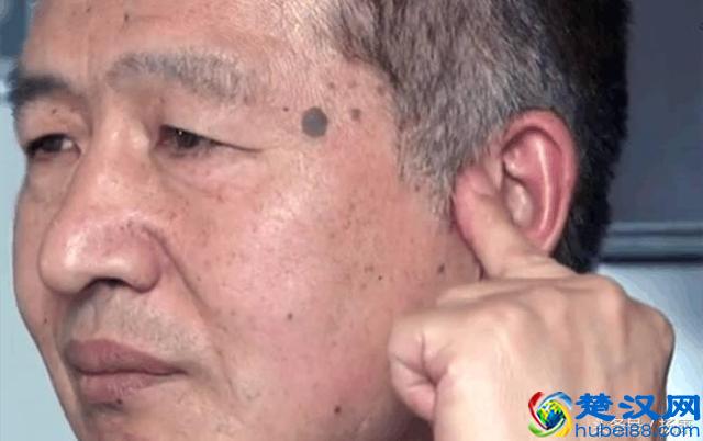 原来常耳鸣是这些因素造成，按揉这两个穴位可很好的缓解耳鸣症状