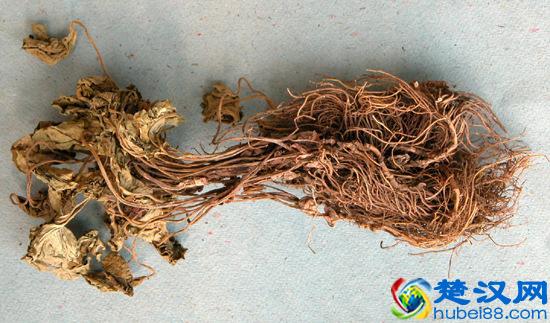 烦人的耳鸣你有吗？三种方法治疗耳鸣！