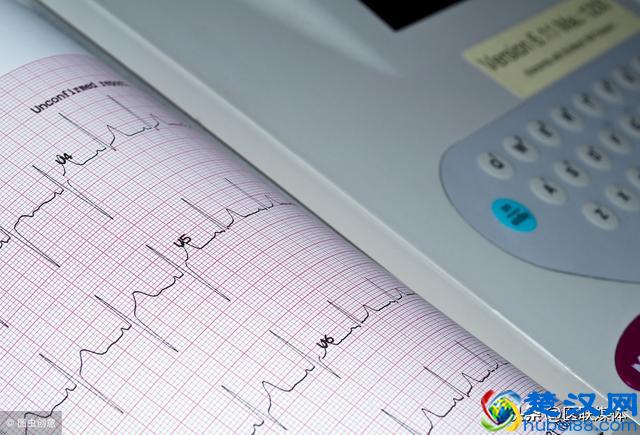 查出“心脏早搏”是什么意思？这个解释很详细