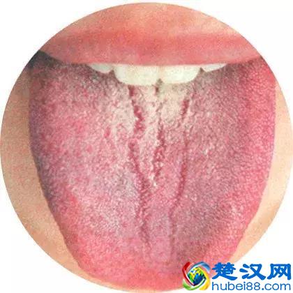 治疗肝硬化，你用对了药吗？最全治疗肝硬化中成药！