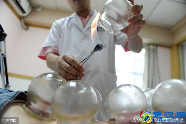 拔火罐有哪些好处和坏处？先了解清楚再去拔，并非每个人都适合！
