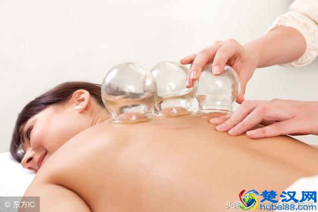 拔火罐有哪些好处和坏处？先了解清楚再去拔，并非每个人都适合！