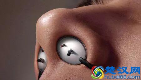 鼻塞不通气怎么办？几个小妙招帮你快速解决！