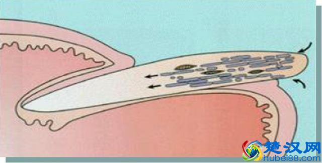 “得了灰指甲，一个传染俩”？别害怕！最正规的治疗指南来了