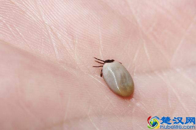 螨虫是什么 螨虫的危害 螨虫感染的症状