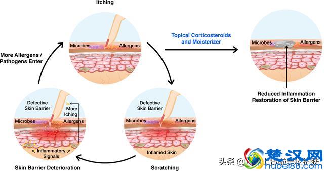 什么是皮肤屏障？皮肤屏障受损，怎么破？
