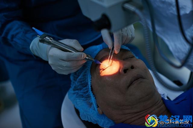 沙眼怎么治？眼科专家有说法