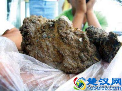 “太岁”究竟是个什么东西？来看看全国所发现的部份“太岁”长得啥样