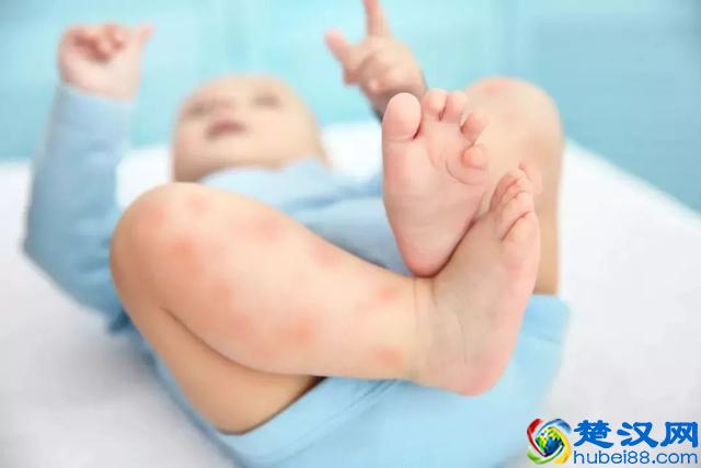 炉甘石洗剂，宝宝用好，您用也好