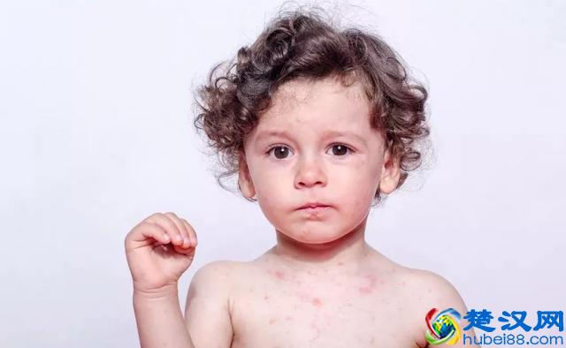 炉甘石洗剂，宝宝用好，您用也好