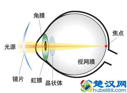 什么是散光？和正常眼睛相比，看东西有什么不同？