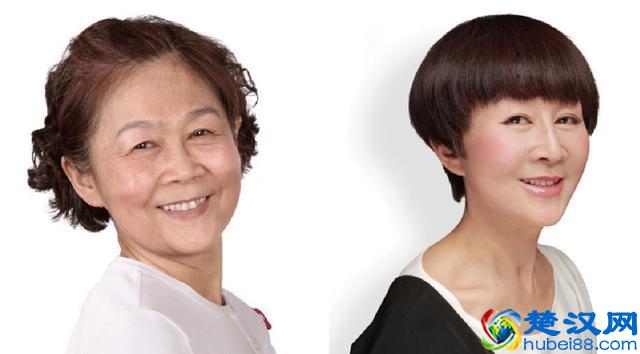 祛除鱼尾纹多少钱 你知道吗？