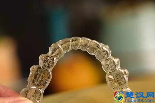 牙齿矫正到底要多少钱？