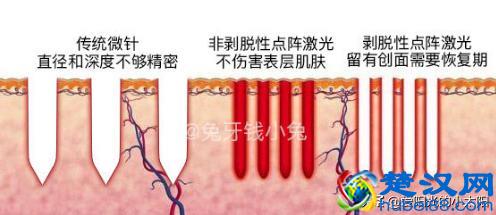 是噱头还是真本事？11款网红超人气家用美容仪实测经验分享