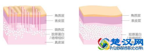 是噱头还是真本事？11款网红超人气家用美容仪实测经验分享