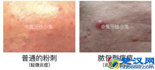 是噱头还是真本事？11款网红超人气家用美容仪实测经验分享