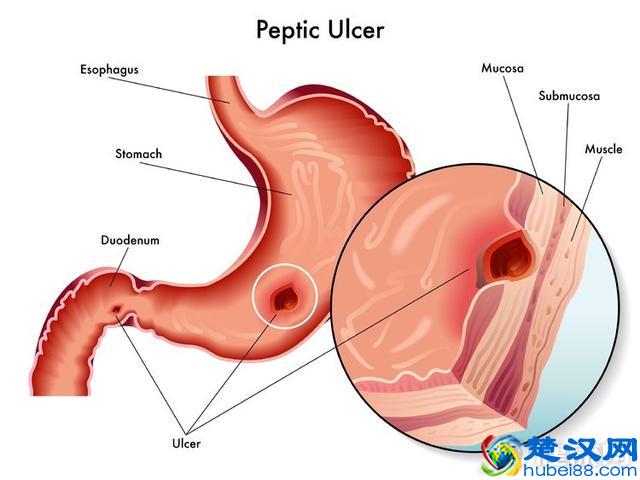 经常胸口疼不一定是心脏病，有4个原因也能引起